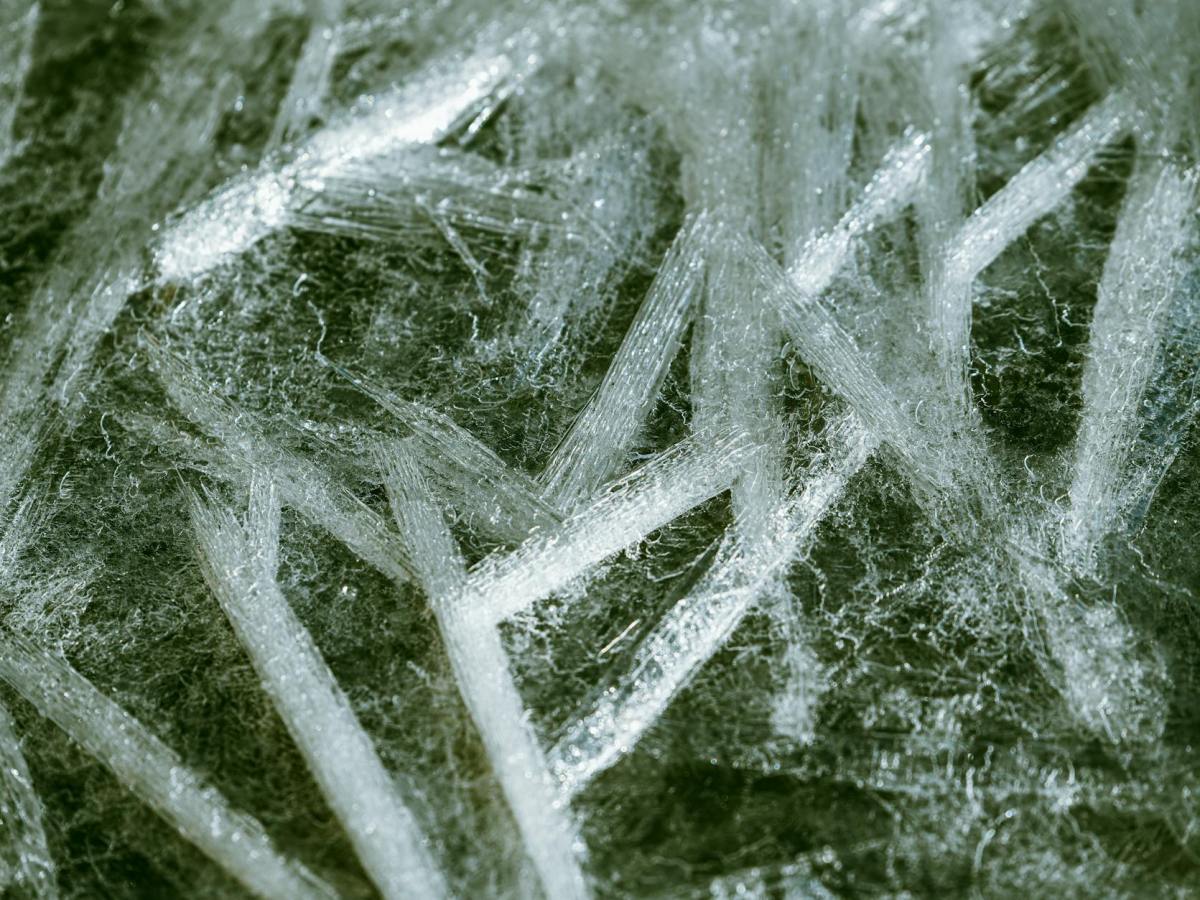 El lado blanco del cerebro: la clave de la velocidad&nbsp;mental